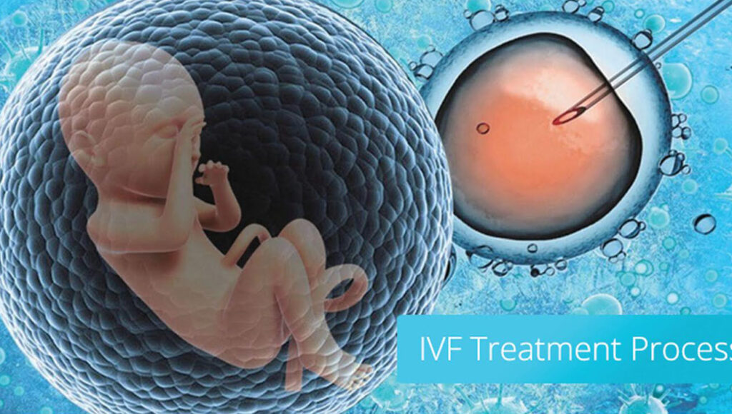IVF Failure in Nigeria