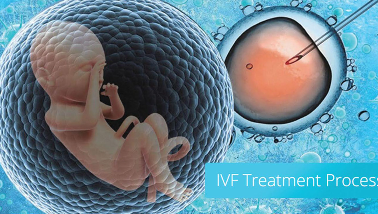 IVF Failure in Nigeria